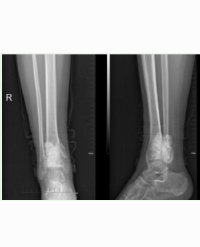 Article Image 1