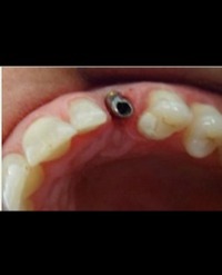 Article Image 1