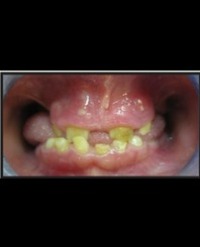 Article Image 1