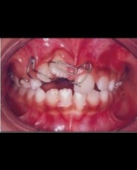 Article Image 1