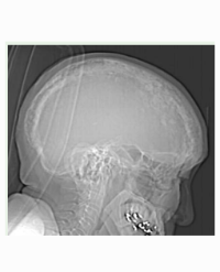 Article Image 1