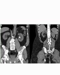 Article Image 1