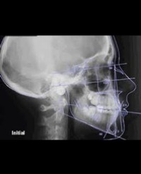 Article Image 1