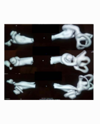 Article Image 1