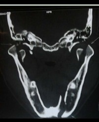 Article Image 1