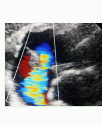 Article Image 1
