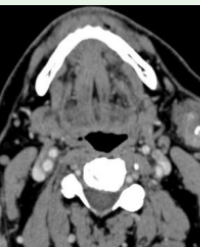 Article Image 1