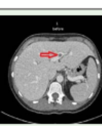 Article Image 1