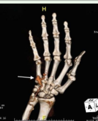 Article Image 1