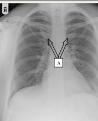 Article Image 1