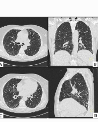Article Image 1