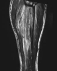 Article Image 1