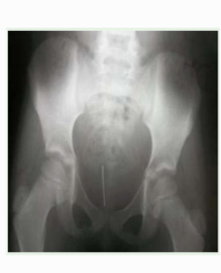 Article Image 1