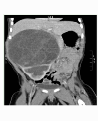 Article Image 1