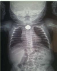Article Image 1