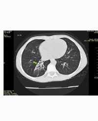 Article Image 1