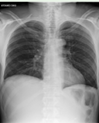 Article Image 1