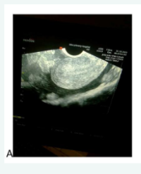 Article Image 1