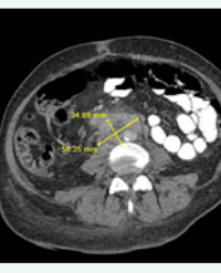 Article Image 1