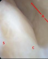 Article Image 1