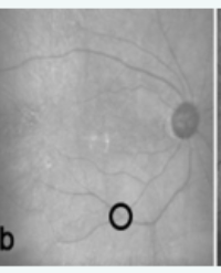 Article Image 1