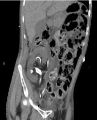 Article Image 1