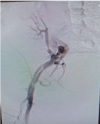 Article Image 1