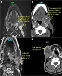 Article Image 1