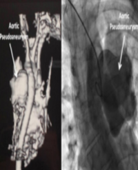 Article Image 1