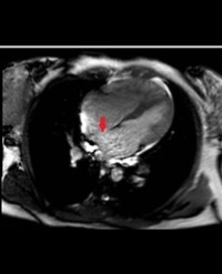 Article Image 1