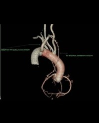 Article Image 1