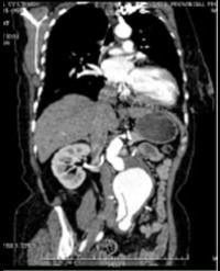 Article Image 1