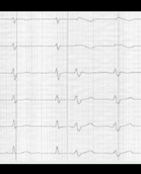 Article Image 1