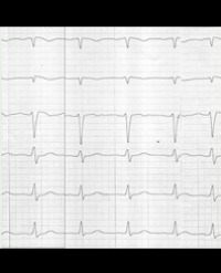 Article Image 1