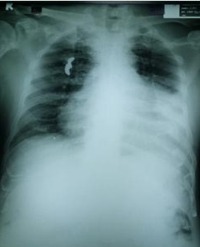 Article Image 1