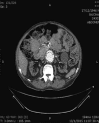Article Image 1