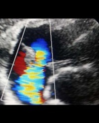 Article Image 1