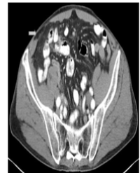 Article Image 1