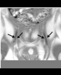 Article Image 1