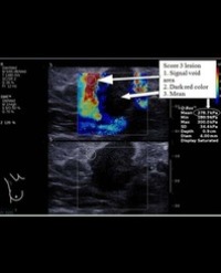 Article Image 1