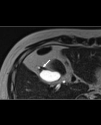 Article Image 1