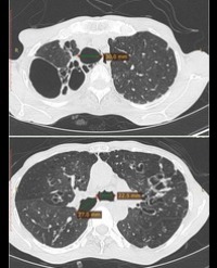 Article Image 1