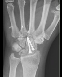 Article Image 1