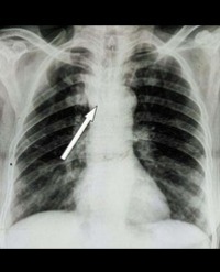 Article Image 1