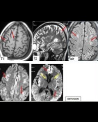 Article Image 1