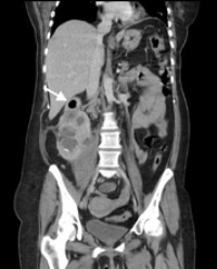 Article Image 1