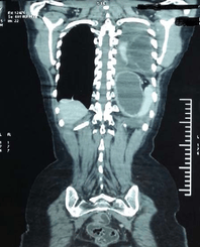 Article Image 1