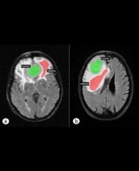 Article Image 1
