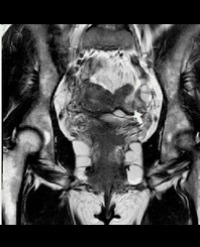 Article Image 1