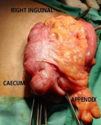 Article Image 1